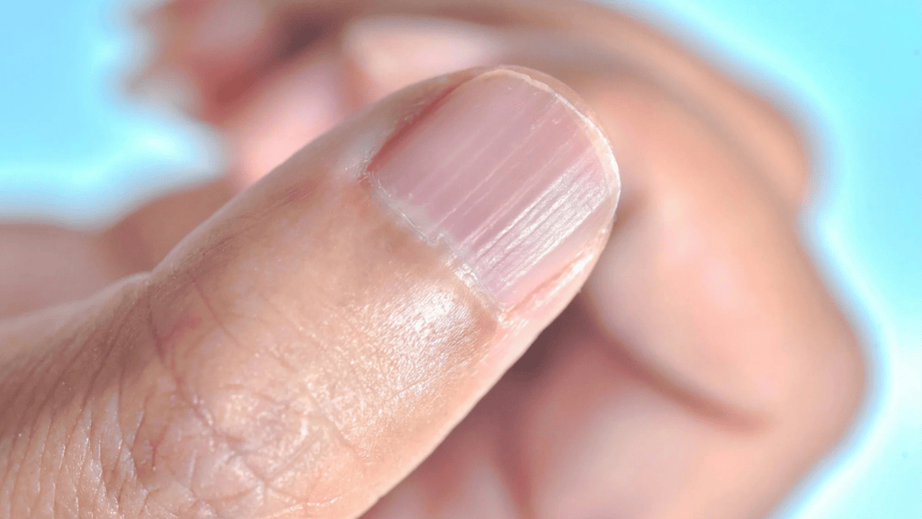 What Are the Structures Under the Nail Plate