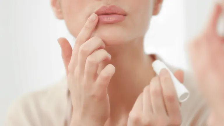 Aquaphor for Lips