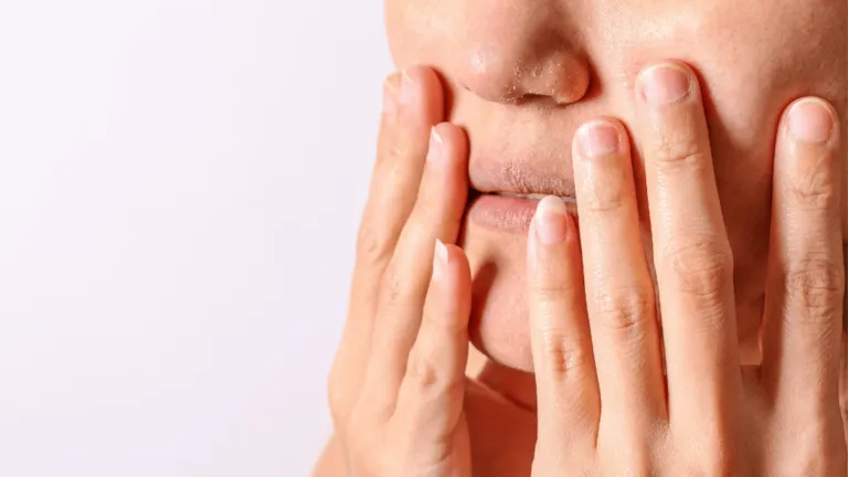 Allergic Reaction on Lips