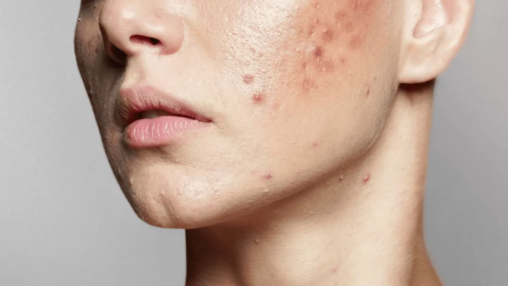 The Benefits of Tretiheal Cream for Skin Rejuvenation The Benefits of Tretiheal Cream for Skin Rejuvenation