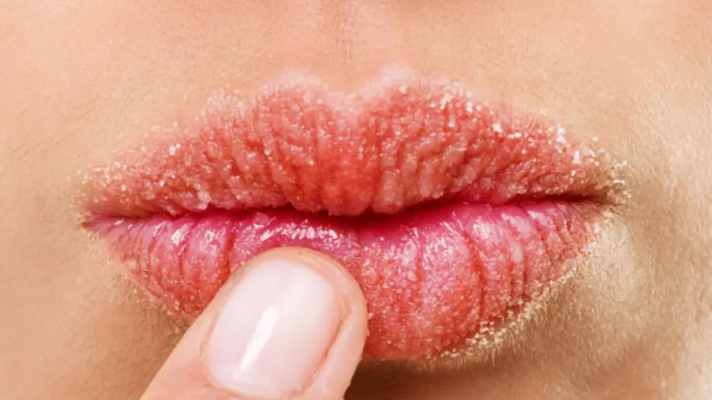 Common Allergens That Affect the Lips