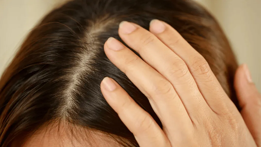 scalp